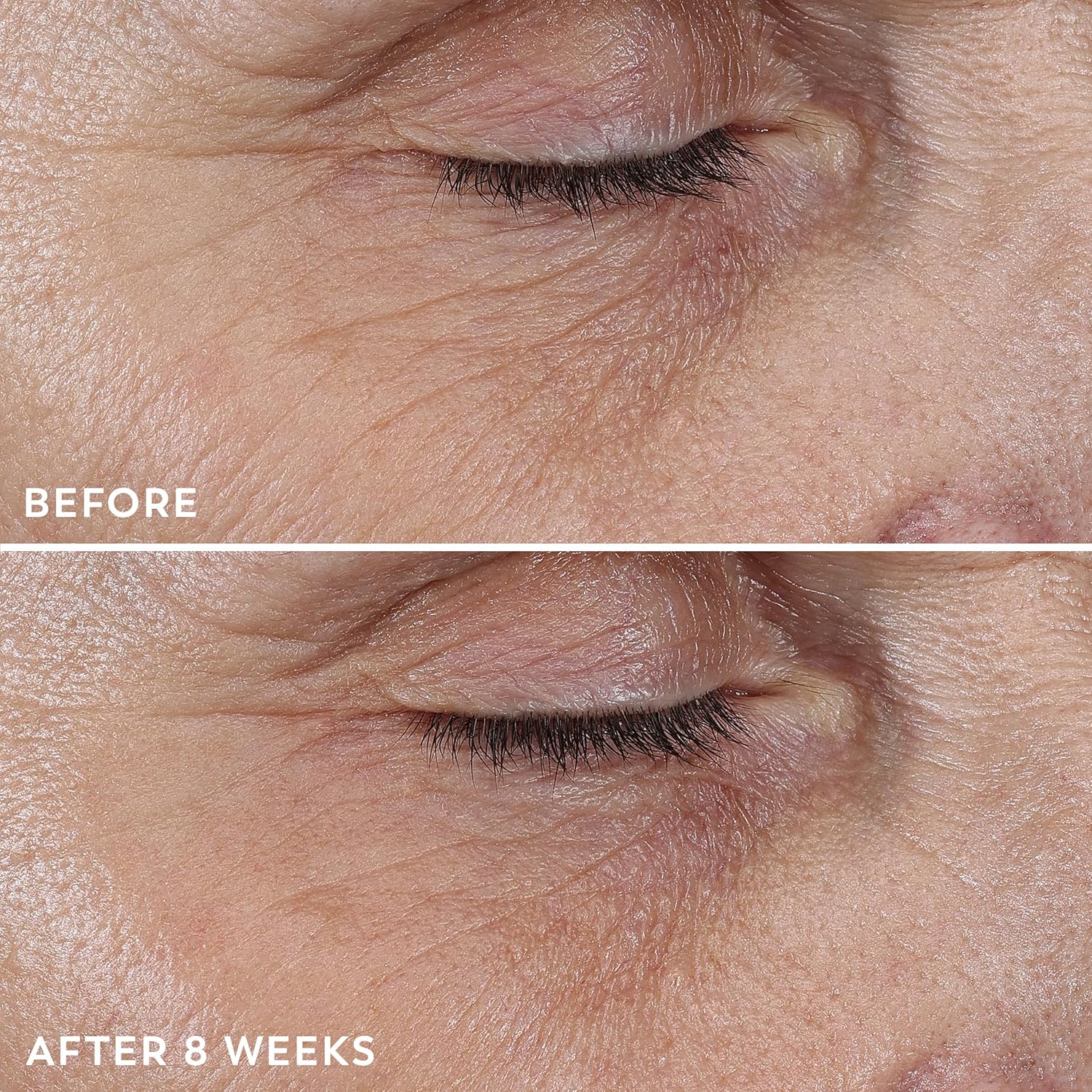 Before and after results from Olay Regenerist — 8 weeks of use, from Olay clinical study